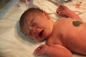 The Chronicles of Polzin: From 3 to 4 but so much more