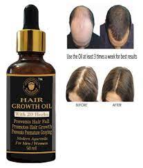 Is the article saying just by applying peppermint oil to the skin promotes hair growth without any major side effects? Daarimooch Ayurvedic Hair Oil For Hair Growth Men Women 50 Ml Buy Daarimooch Ayurvedic Hair Oil For Hair Growth Men Women 50 Ml At Best Prices In India Snapdeal