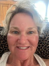 Well kids your friend here did a treatment and I guess I do swell from a  laser🤣 So, since I am blowing up by the minute we will be postponing our  video