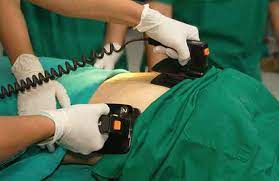 Need implantable automatic defibrillator coverage? Additional Info For The Bmj
