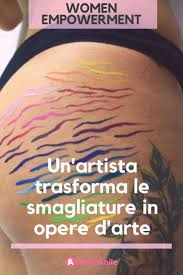 Cinta Tort Cartro Un Artista Di 21 Anni Ha Realizzato Un Progetto Straordinario Sulla Bellezza Delle Imperfezioni E Il Risultato Smagliature Artisti Emozioni