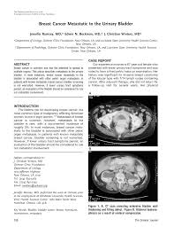 Make an appointment with your doctor if you notice anything unusual. Pdf Breast Cancer Metastatic To The Urinary Bladder