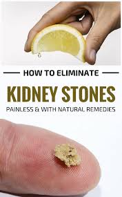 How To Eliminate Kidney Stones Painless And With Natural Remedies Natural Remedies Kidney Stones Kidney Stones Remedy