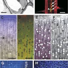 Maybe you would like to learn more about one of these? Pdf Xylem Cell Death Emerging Understanding Of Regulation And Function