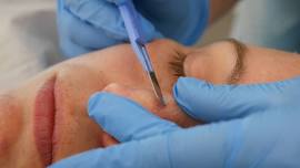 VTCT Level 4 Award In Dermaplaning