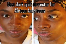 The best scar creams reduce their appearance and promote your skin's health. Best Dark Spot Corrector For African Americans Dark Spot Correctors Best Dark Spot Corrector Black Skin Care American Skin