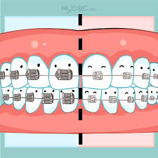 Clinic address is 54, jln cerdas, tmn connaught, cheras, kuala lumpur ( ground floor). 79 Best Damon Braces In Malaysia Price Guide Reviews
