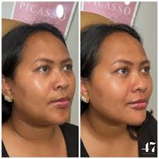 Cameron Bowling, BSN, RN (@injectorcam) · Instagram 照片和视频