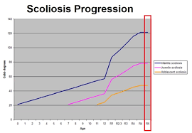 Scoliosis In Children Hudson Valley Scoliosis