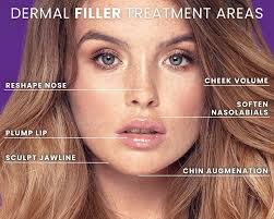 Juvéderm Filler Aurora & Centennial, CO