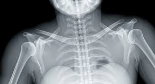 Image result for Shoulder Imaging