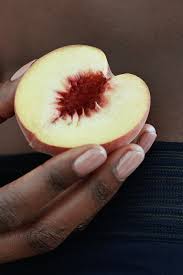 Normal findingslabia majora andminora symmetrical smooth to somewhat wrinkled, unbroken, slightly pigmented skin surface. Is My Hymen Normal Types Of Hymenal Abnormalities