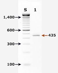 Gastrointestinal disease caused by the apicomplexan parasite cryptosporidium parvum is one of the most important diseases of young ruminant livestock, particularly neonatal calves. Cdc Dpdx Cryptosporidiosis Diagnostic Findings