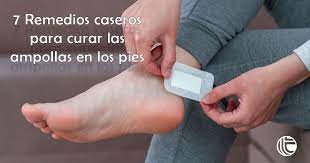 Como Curar Ampollas En Los Pies Con Remedios Caseros Tarrats Es
