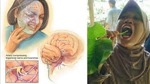 We did not find results for: Kesal Sakit Gigi Tak Kunjung Sembuh Obati Dengan Ramuan Sakti Tradisional Ini Tribun Jabar