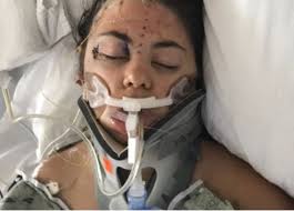 They shaved their heads after Dilynn's had to be shaved for brain surgery —  a powerful promise that she is not alone in this fight. Not for a single  second. It's been