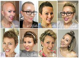 The Number One Thought On Most Women S Minds During And After Chemo Is How And When Will My Hair G Growing Out Hair Hair Growth After Chemo Hair Regrowth Women