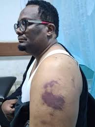 I am beyond livid & sad I told Meshe Habana to clear my afternoon because I  must visit the family of the car spinners that was brutally gunned down, 3  of them