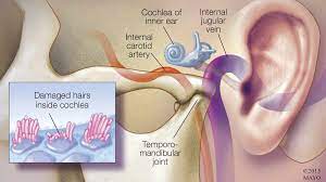 Tinnitus Resources Hearing Health Foundation