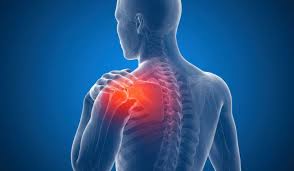 Image result for Frozen Shoulder