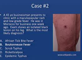 Image result for Rickettsialpox