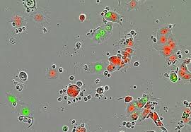 Check spelling or type a new query. Breast Cancer Can Form Sleeper Cells After Drug Treatment Imperial News Imperial College London