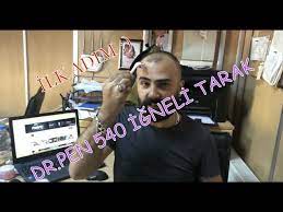 Dermaroller 540 Igneli Titanyum Sac Cikarma Taragi Saclosyonu Sactarak Sacserumu Maviserum Youtube