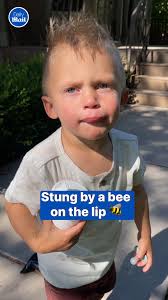 He deserves a treat for being so brave