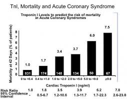Acute Coronary Syndrome Workup Approach Considerations