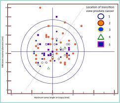 prostate cancer is the most commonly diagnosed cancer (apart from skin cancers) in kiwi men. Transition Zone And Anterior Stromal Prostate Cancers Evaluation Of Discriminant Location Criteria Using Multiparametric Fusion Guided Biopsy Sciencedirect