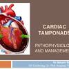 Acute pericarditis is most commonly caused by viral infection; 1