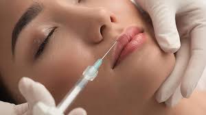 Lippen aufspritzen | Fort Malakoff Klinik