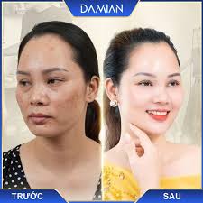 Viên Uống Damian Chính Hãng