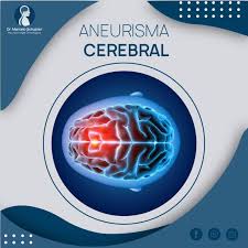 O que é um aneurisma? Aneurisma Cerebral Dr Marcelo Schuster