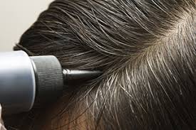 Can your hair grow back while on chemo? Hair Dye Use During Chemotherapy Oncology Nurse Advisor