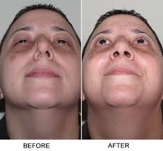 Michael Yaker, MD, 620 Columbus Ave, Ste 2, New York, NY 10024, US