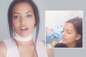 Watch Ex On The Beach star Loren Green get botched lip fillers dissolved in  graphic procedure