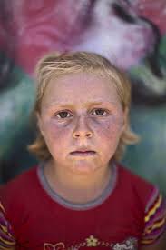 Tolls Of War Syrian Children Take Refuge In Jordan Syrian Children Refugee Kids Portraits
