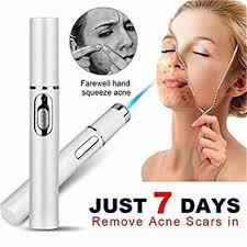 Blue Light Therapy Acne Laser Pen Soft Scar Wrinkle Removal Treatment  Device Skin Care Beauty Equipment at ₹ 1529.00