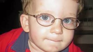 Eye misalignment often helped by surgery