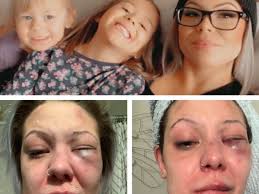 Donate to Helping Mikayla Rise Again, organized by Katarina Tzortzis-Chapman