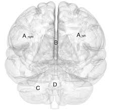 Signals from the brain tell muscles to contract. Coronal Also Labeled Frontal Plane Of Human Brain 1 A Right Download Scientific Diagram