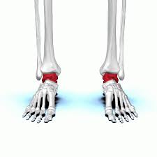 It's the most common type of hand tumor. How Is Bone Cancer Detected Quora