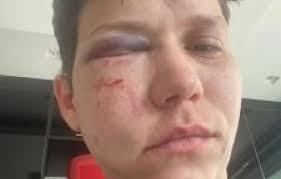 Aliada de Bolsonaro é espancada no Rio de Janeiro