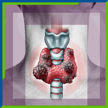 Ultrasound evaluation of the thyroid gland
