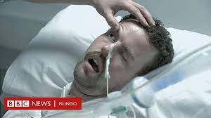 Se pueden afectar los nervios craneales. Atrapado En Tu Propio Cuerpo El Paciente Con Un Caso Extremo Del Sindrome De Guillain Barre Que Logro Comunicarse Con Su Doctor Bbc News Mundo