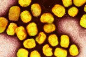 Why the monkeypox outbreak is mostly affecting men who have sex with men |  Science | AAAS