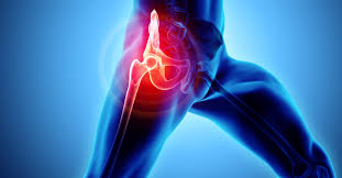 When can I return to work after anterior total hip replacement surgery?
