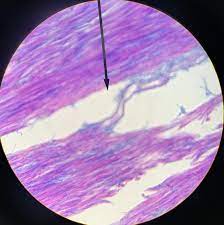 Dense Connective Tissue Tissue Elastin Fiber