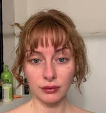 This is my quote from Ahmet ALP If you watch Love Island he did Janas nose  job